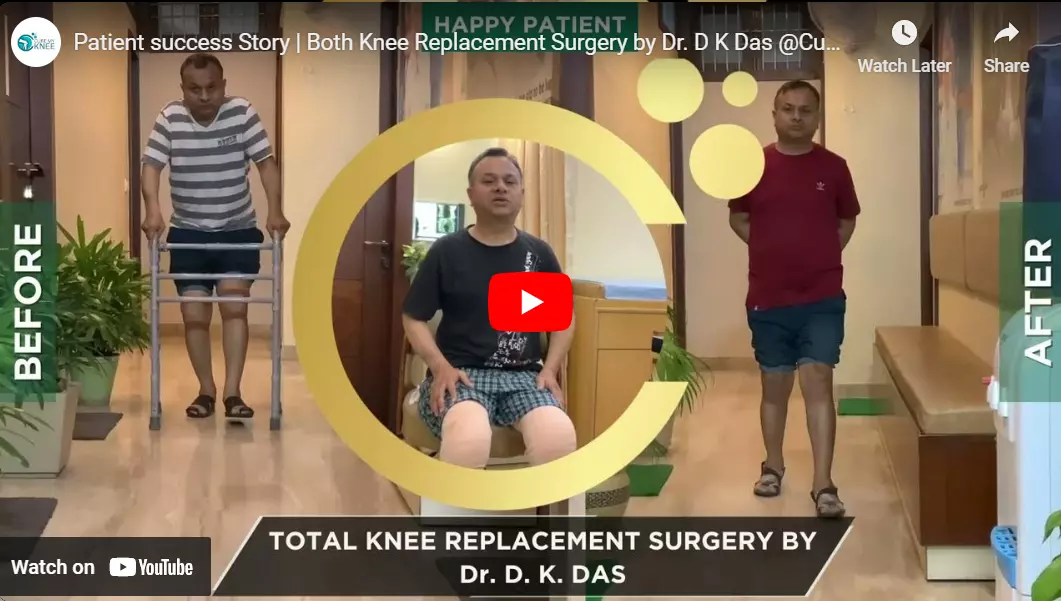video of knee replacement surgery in Delhi performed by Dr DK Das