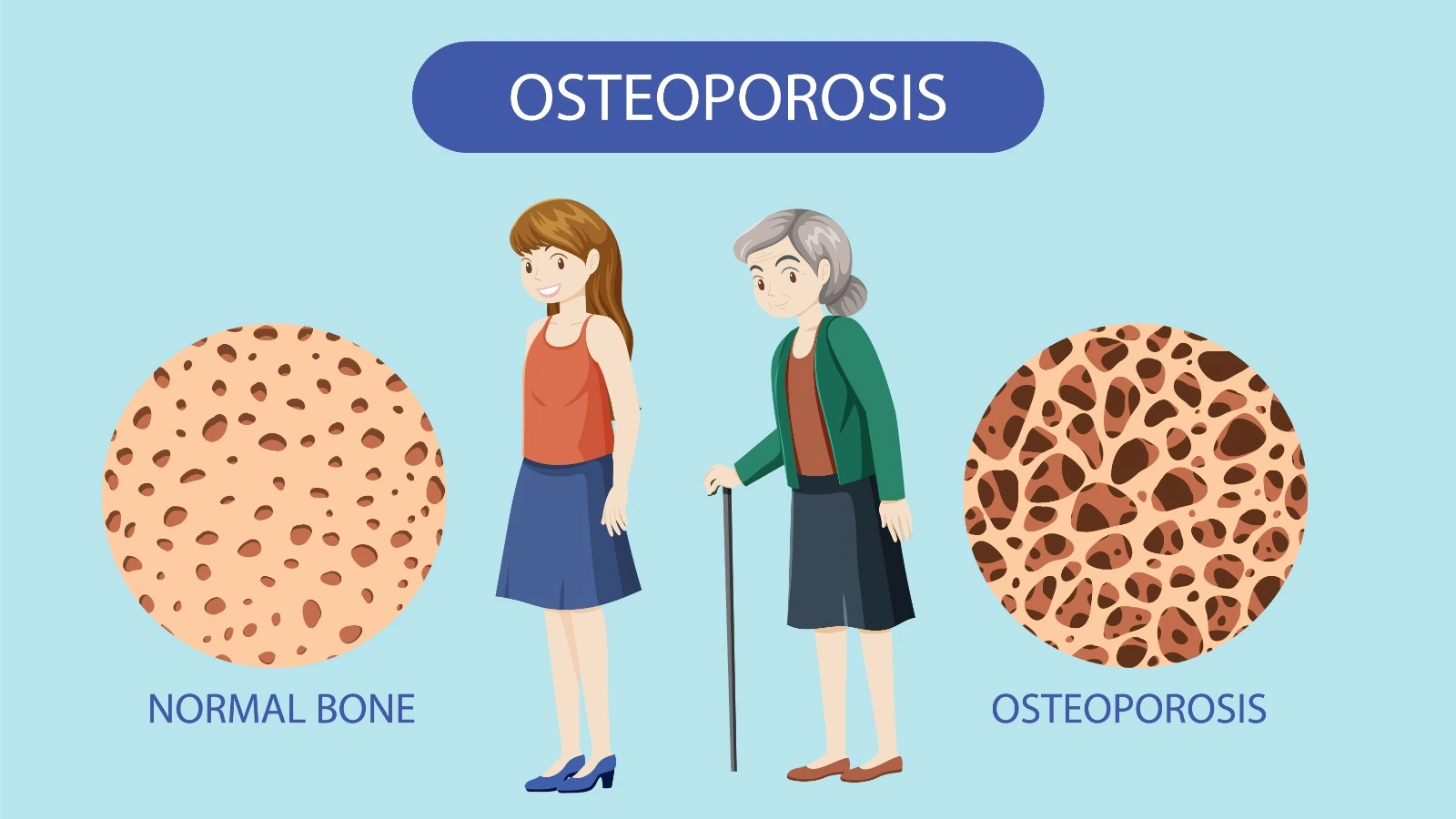 Osteoarthritis: Symptoms, Causes, Treatment in Delhi