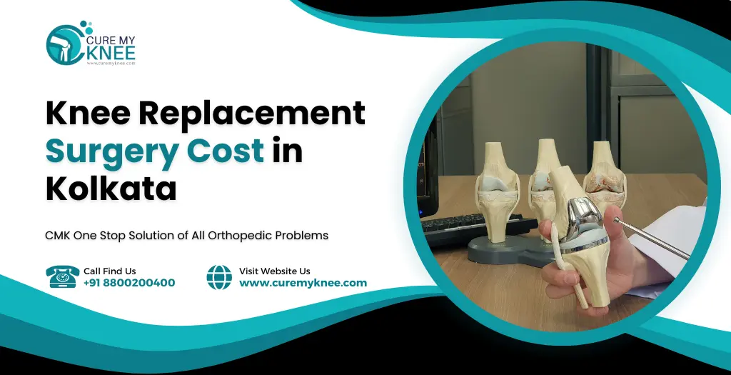 knee replacement surgery cost in kolkata