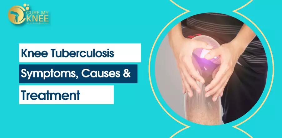Knee Tuberculosis: Symptoms, Causes, Treatment in Delhi