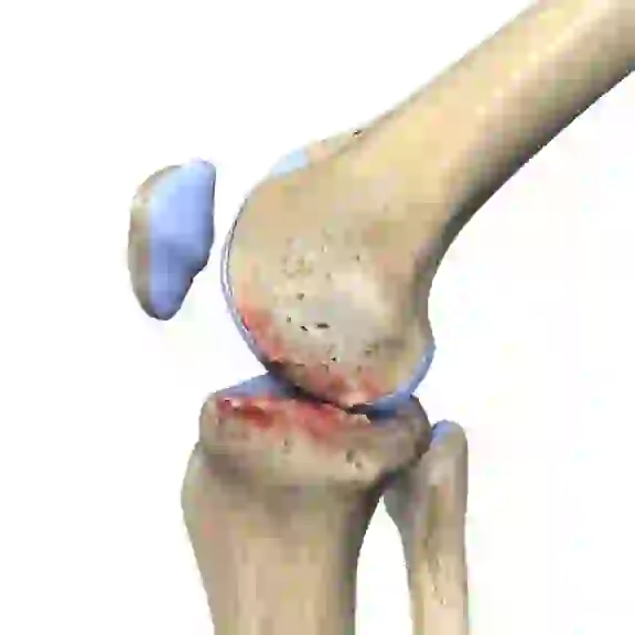 Total Knee Replacement Icon