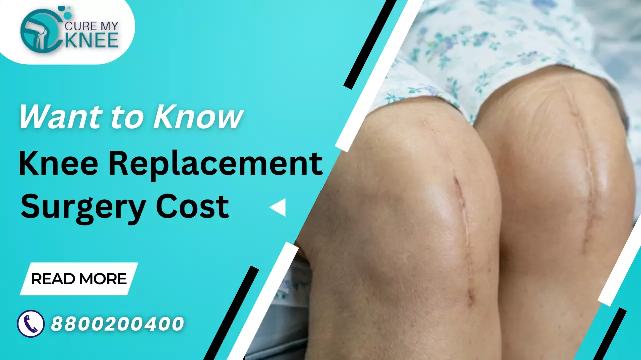 (TKR)Knee Replacement Surgery Cost in Delhi