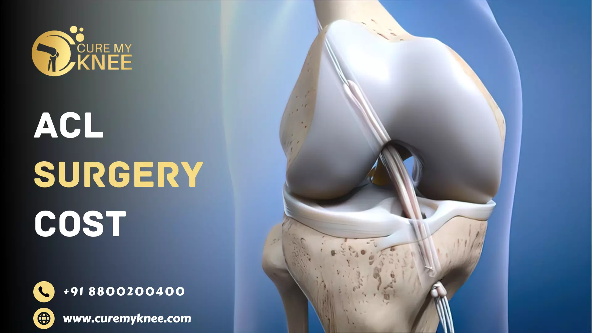 ACL surgery cost in India